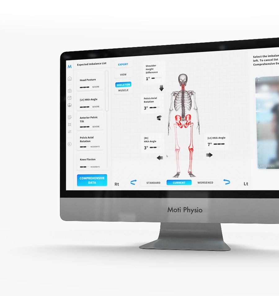 Moti Physio 3D posture scan showing a full body skeleton view on a screen