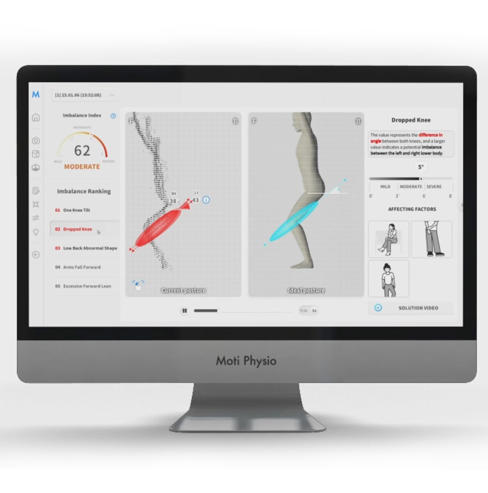 Scan screen showing leg and knee muscle balance in red and blue