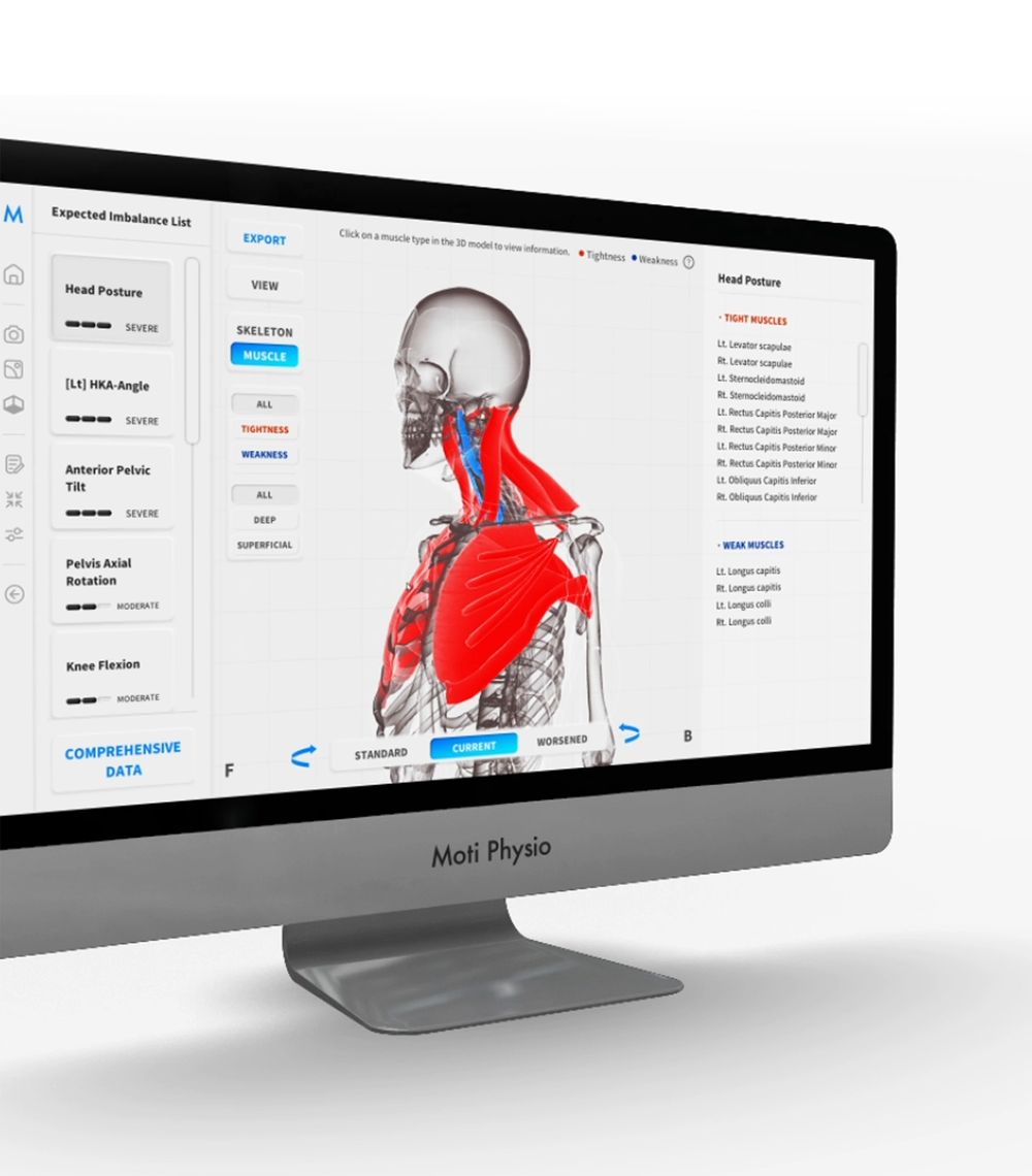 Scan screen showing tight muscles in red and weak muscles in blue on a 3D body