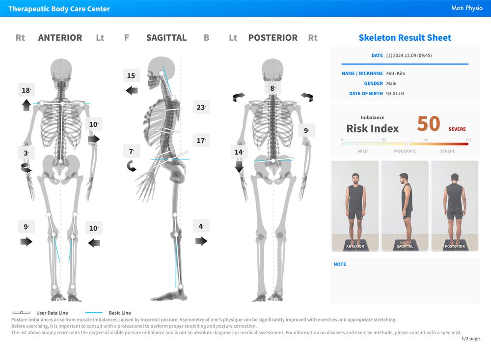 Sample posture scan result sheet with skeleton views